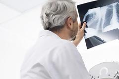 Σε τεντωμένο σχοινί η επιβίωση των Ακτινολόγων