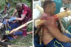 Τα ουρλιαχτά του ακούγονταν σε ολόκληρο το δάσος. Μόλις Δείτε τι έπαθε, θα ανατριχιάσετε [ΣΚΗΡΕΣ ΕΙΚΟΝΕΣ]