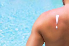 Ηλιακά εγκαύματα: Αντιμετωπίστε τα … φυσικά!