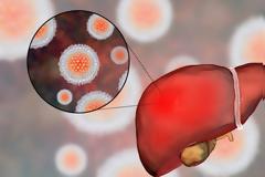 Πώς γίνεται να πεθάνεις από ηπατίτιδα Α – Τι συνέβη στην γυναίκα που έφαγε μολυσμένο ρόδι [video]