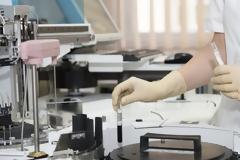 Γερμανία: Ατομικά τεστ αυτοδιάγνωσης του ιού HIV από τα φαρμακεία