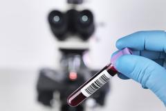 Εξέταση αίματος μπορεί να ανιχνεύσει 10 τύπους καρκίνου, ακόμη και χρόνια πριν αρρωστήσουμε!