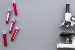 Ανεβασμένες τρανσαμινάσες: Ποιους κινδύνους κρύβουν