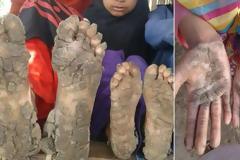 Σάλος με Οικογένεια Ρομά - Όταν είδαμε τα χέρια και τα πόδια των παιδιών τους, μας κόπηκε το αίμα [photos+video]