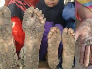 Φωτογραφία για Σάλος με Οικογένεια Ρομά - Όταν είδαμε τα χέρια και τα πόδια των παιδιών τους, μας κόπηκε το αίμα [photos+video]