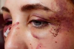 Πόση πλέον απανθρωπιά; Αλήθεια, κρίμα! Ντροπή σε όλους μας... Τι έφταιξε το άμοιρο το κοριτσάκι;