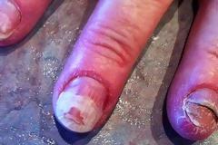 ΣΟΚΑΡΙΣΤΙΚΟ: Τα νύχια αυτής της γυναίκας καταστράφηκαν με κάτι που κάνουν όλες οι γυναίκες [photo]