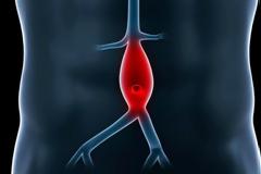 Ανεύρυσμα καρδιάς: Δείτε πού οφείλεται και τι μπορεί να προκαλέσει