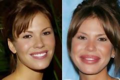 Δείτε τις πλαστικές επεμβάσεις που πήγαν στραβά...πολύ στραβά! [photos]