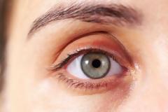 Δέκα σημάδια ασθένειας που φαίνονται στο πρόσωπο