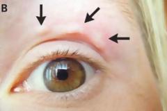 Βλέπετε αυτό το περίεργο “εξόγκωμα” στο μάτι της; Μόλις μάθετε τι είναι θα έχετε εφιάλτες [photo]