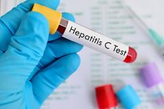 Περισσότεροι από 75.000 άνθρωποι πάσχουν από Ηπατίτιδα C χωρίς να το γνωρίζουν!