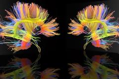 Σε ποιο φύλο ανήκει ο εγκέφαλός σας;