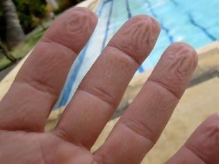 Φωτογραφία για Γιατί ζαρώνουν τα δάχτυλά σας μέσα στο νερό – Όχι, δεν είναι επειδή «μούλιασαν»…