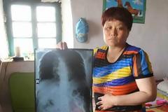 Απίστευτο! Της έκαναν ακτινογραφία και δείτε τι ανακάλυψαν...