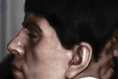 Ο άντρας με τα 2 πρόσωπα! Είχε ένα κανονικό και ένα στο πίσω μέρος του κεφαλιού του [video]