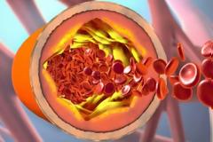 Τι είναι η χοληστερόλη και πώς την χρησιμοποιεί ο οργανισμός – Πότε υπάρχει πρόβλημα [video]