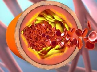 Φωτογραφία για Τι είναι η χοληστερόλη και πώς την χρησιμοποιεί ο οργανισμός – Πότε υπάρχει πρόβλημα [video]