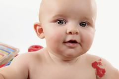 Τι σημαίνουν τα σημάδια που έχουμε εκ γενετής;