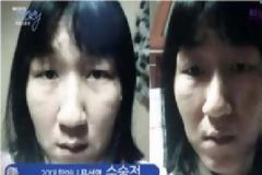 Έκανε πλαστικές και έγινε… αγνώριστη! [photos]