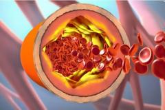 Τι είναι η χοληστερόλη και πώς την χρησιμοποιεί ο οργανισμός – Πότε υπάρχει πρόβλημα (Video)