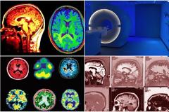 Μηχανές ανάγνωσης της σκέψης