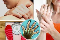 Ρευματοειδής Αρθρίτιδα: βέλτιστη θεραπεία και ποιοτικότερη ζωή με τη συνεργασία γιατρού – ασθενούς