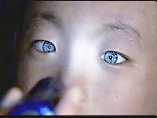 Φωτογραφία για Το αγόρι που τρέλανε την επιστημονική κοινότητα: Έχει την ικανότητα να βλέπει στο απόλυτο… σκοτάδι με μάτια που λάμπουν! [video]