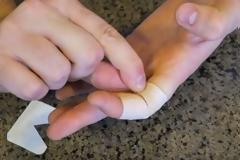 Και όμως βάζετε το τραυμαπλάστ με λάθος τρόπο τόσα χρόνια! Δείτε πώς γίνεται σωστά