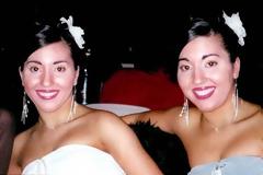 Δίδυμες ξόδεψαν 180.000 ευρώ για να γίνουν... ακόμα πιο όμοιες