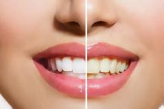 Τα καλύτερα tricks για λευκά δόντια