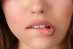 Γιατί δαγκώνουμε τα χείλη μας; Ποια τα αίτια και πώς αντιμετωπίζεται