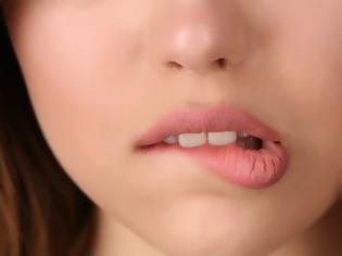 Φωτογραφία για Γιατί δαγκώνουμε τα χείλη μας; Ποια τα αίτια και πώς αντιμετωπίζεται