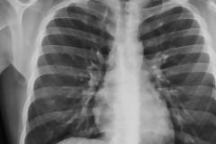 Ηράκλειο: Το 