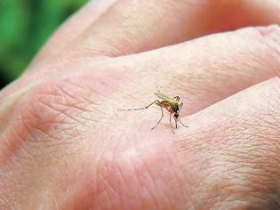 Φωτογραφία για Ποια συμπτώματα μπορούν να υποδηλώνουν ότι είμαστε αλλεργικοί στο τσίμπημα κουνουπιού;