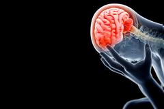 ΑΠΙΘΑΝΟ! Εσύ ήξερες ότι υπάρχουν λέξεις που... πονάνε τον εγκέφαλο σου;