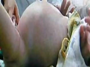 Φωτογραφία για Η κοιλιά αυτού του μωρού άρχισε να φουσκώνει...  Όταν μάθαμε την αιτία σοκαριστήκαμε! [video]