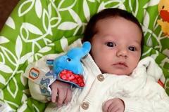 Αυτό που συνέβηκε σε αυτό το μωράκι συμβαίνει μία στις 133.000 φορές