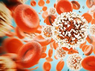 Φωτογραφία για Επιστήμονες κατάφεραν να κάνουν και πάλι ευαίσθητα στα φάρμακα ορισμένα καρκινικά κύτταρα