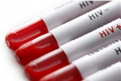 Ελπίδα από νέο εμβόλιο κατά του HIV - Τα πρώτα σημαντικά ευρήματα των δοκιμών