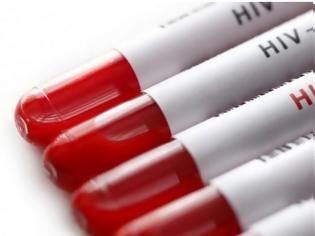 Φωτογραφία για Ελπίδα από νέο εμβόλιο κατά του HIV - Τα πρώτα σημαντικά ευρήματα των δοκιμών