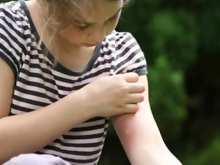 Φωτογραφία για Τα κουνούπια δεν πάνε διακοπές: Τρόποι προστασίας για τα παιδιά