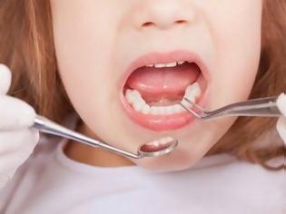 Φωτογραφία για ΣΟΚΑΡΙΣΤΙΚΟ: Δεν φαντάζεστε πόσα δόντια είχε ένα 7χρονο κοριτσάκι μέσα στο στόμα του [photo]