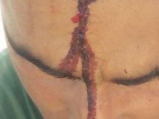 Φωτογραφία για Αχαΐα: Χτύπησε με αξίνα στο κεφάλι εργάτη γιατί ζήτησε τα δεδουλευμένα του