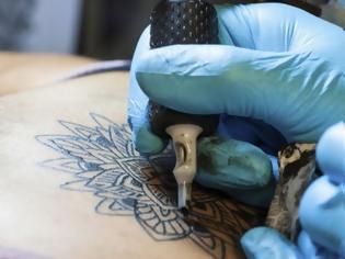 Φωτογραφία για Θέλεις να απαλλαγείς από το τατουάζ σου; Πώς θα το αφαιρέσεις;