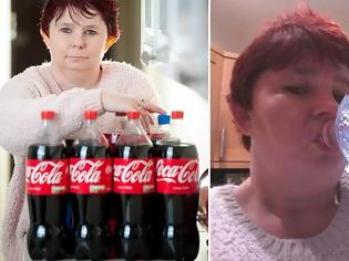 Φωτογραφία για Πίνει 6 Λίτρα Coca cola τη μέρα - Το αποτέλεσμα; Θα σας σοκάρει... [photos]