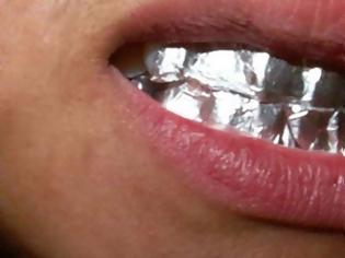 Φωτογραφία για Φοβερό: Ξέρετε τι θα συμβεί, αν βάλετε φύλλο αλουμινίου στα δόντια σας για 1 ώρα;