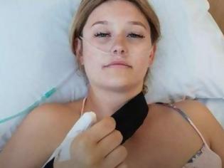 Φωτογραφία για Απίστευτο: Έτρωγε τα νύχια της και έπαθε καρκίνο – Της έκοψαν τον αντίχειρα