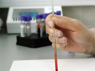 Φωτογραφία για Για πρώτη φορά τεστ αίματος αποκαλύπτει τι ώρα είναι... μέσα στο ανθρώπινο σώμα!