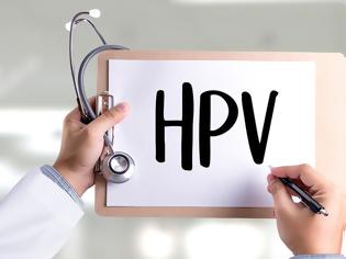 Φωτογραφία για Μύθοι και αλήθειες για τα κονδυλώματα και τον ιό HPV